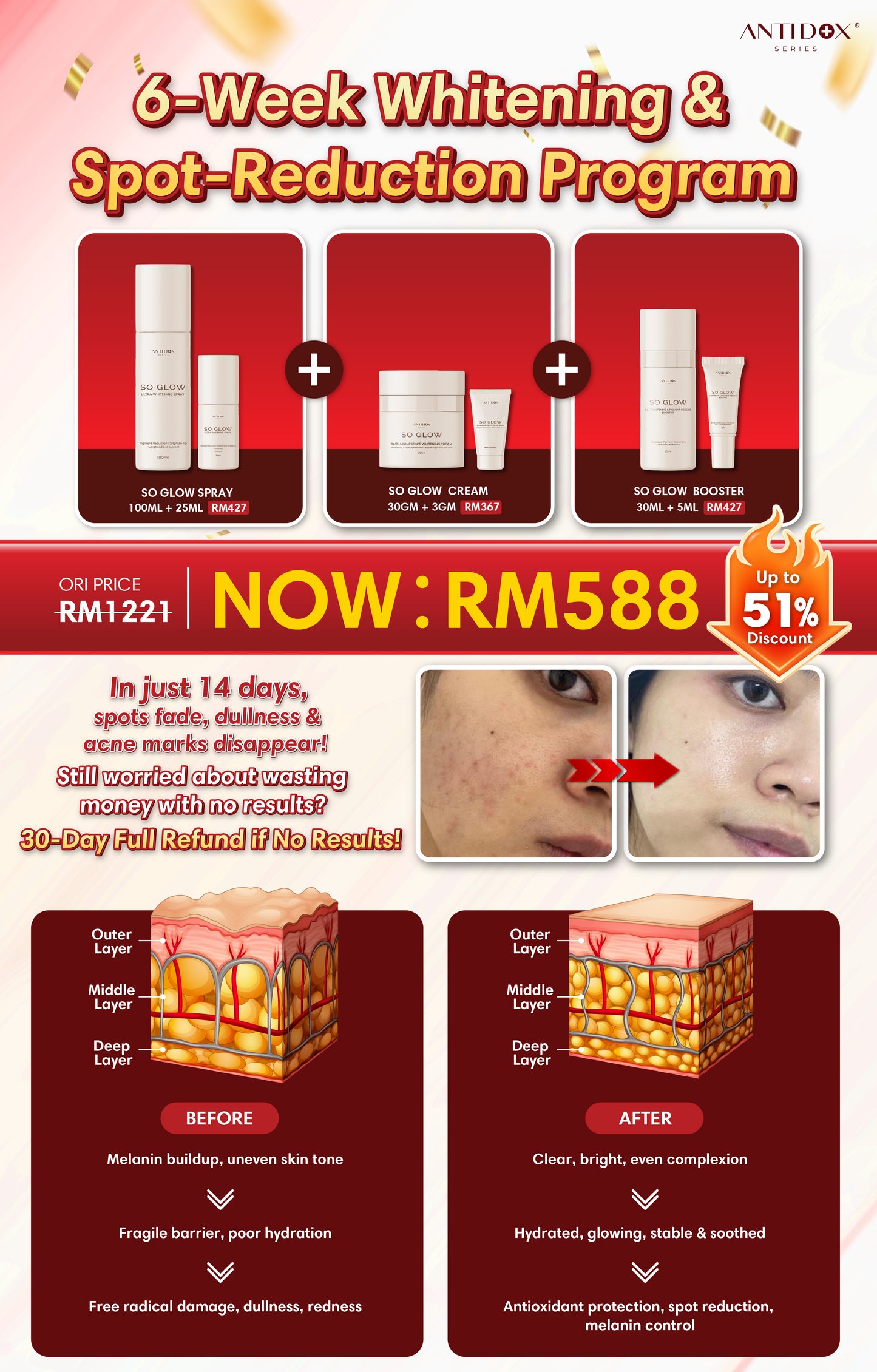 OCT SOLIFT 6-Week Treatment Package