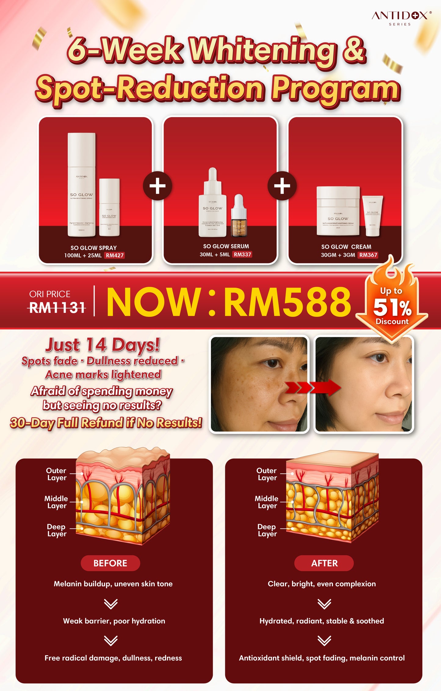 OCT SOLIFT 6-Week Treatment Package