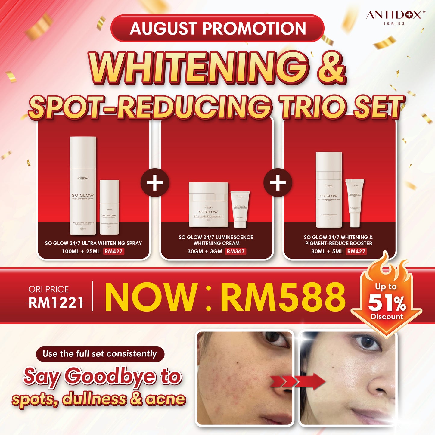 AUG SOLIFT PROMOTION PACKAGE RM588 WHITENING & SPOT-REDUCING TRIO SET