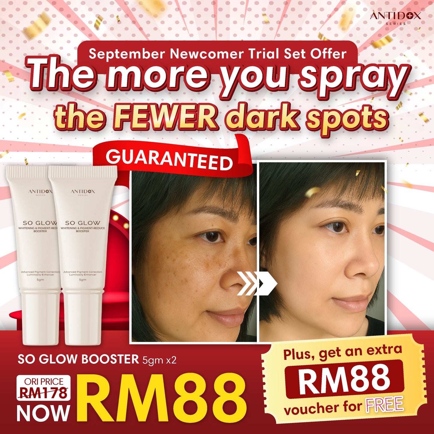SEP SOLIFT TRIAL SET PROMOTION PACKAGE RM88