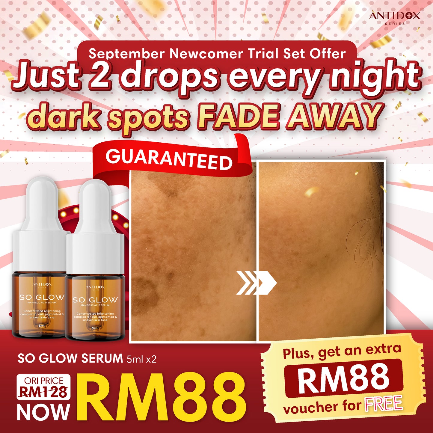 SEP SOLIFT TRIAL SET PROMOTION PACKAGE RM88