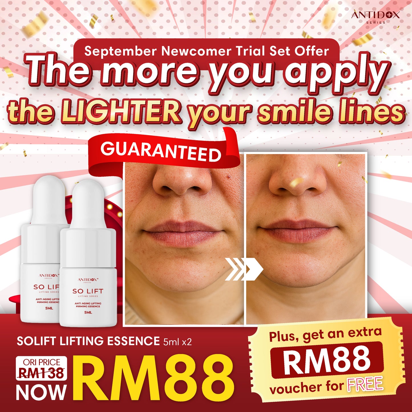 SEP SOLIFT TRIAL SET PROMOTION PACKAGE RM88