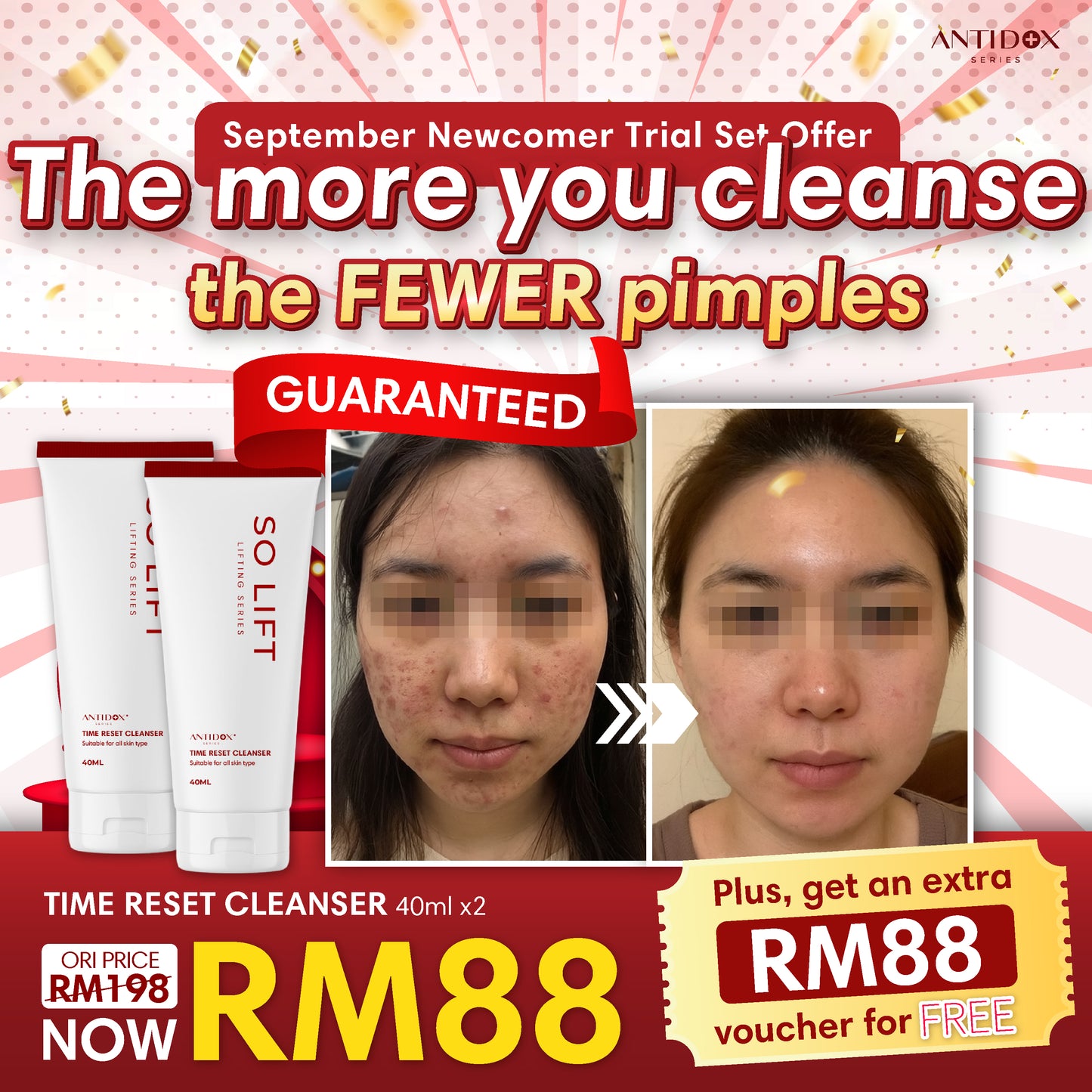 SEP SOLIFT TRIAL SET PROMOTION PACKAGE RM88
