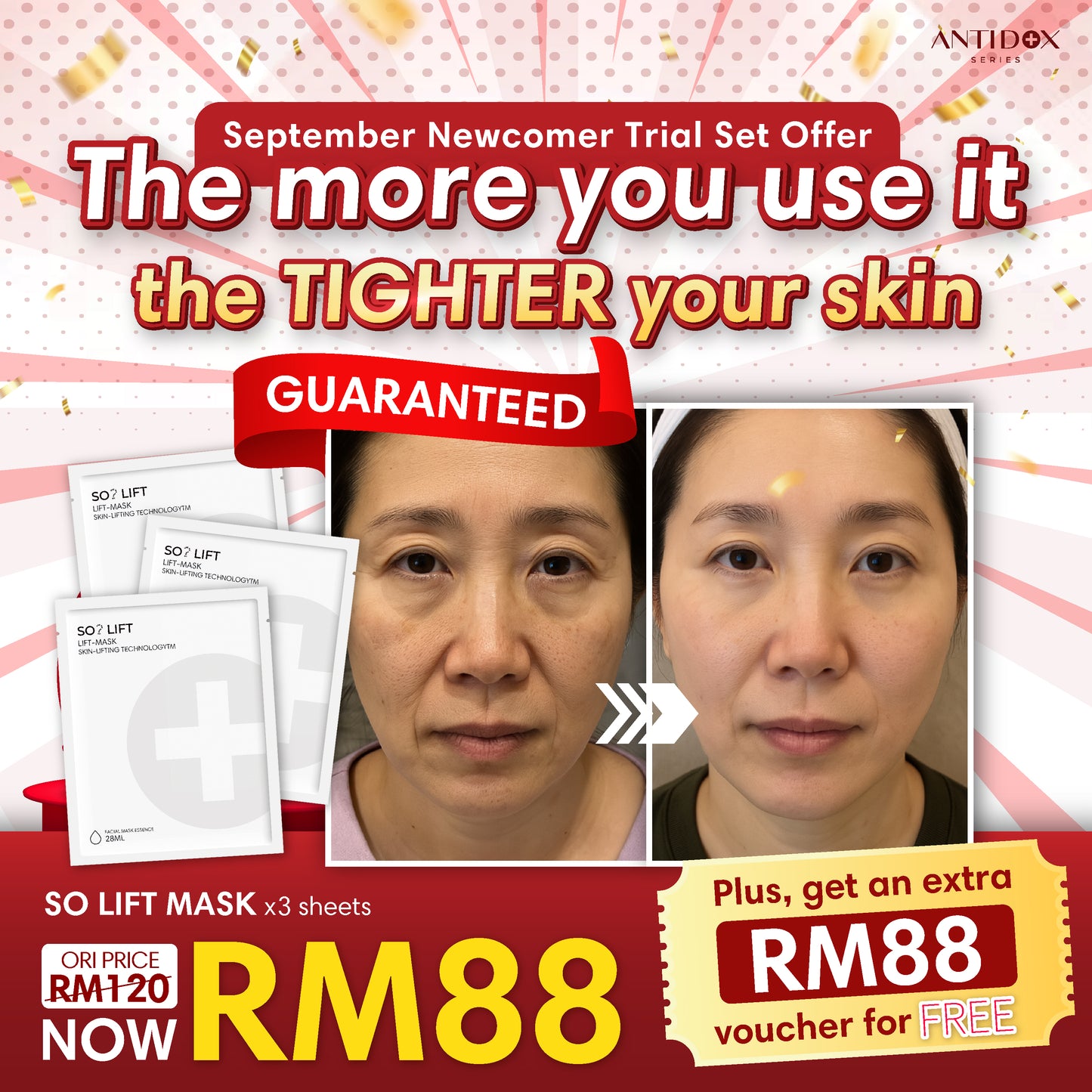 SEP SOLIFT TRIAL SET PROMOTION PACKAGE RM88