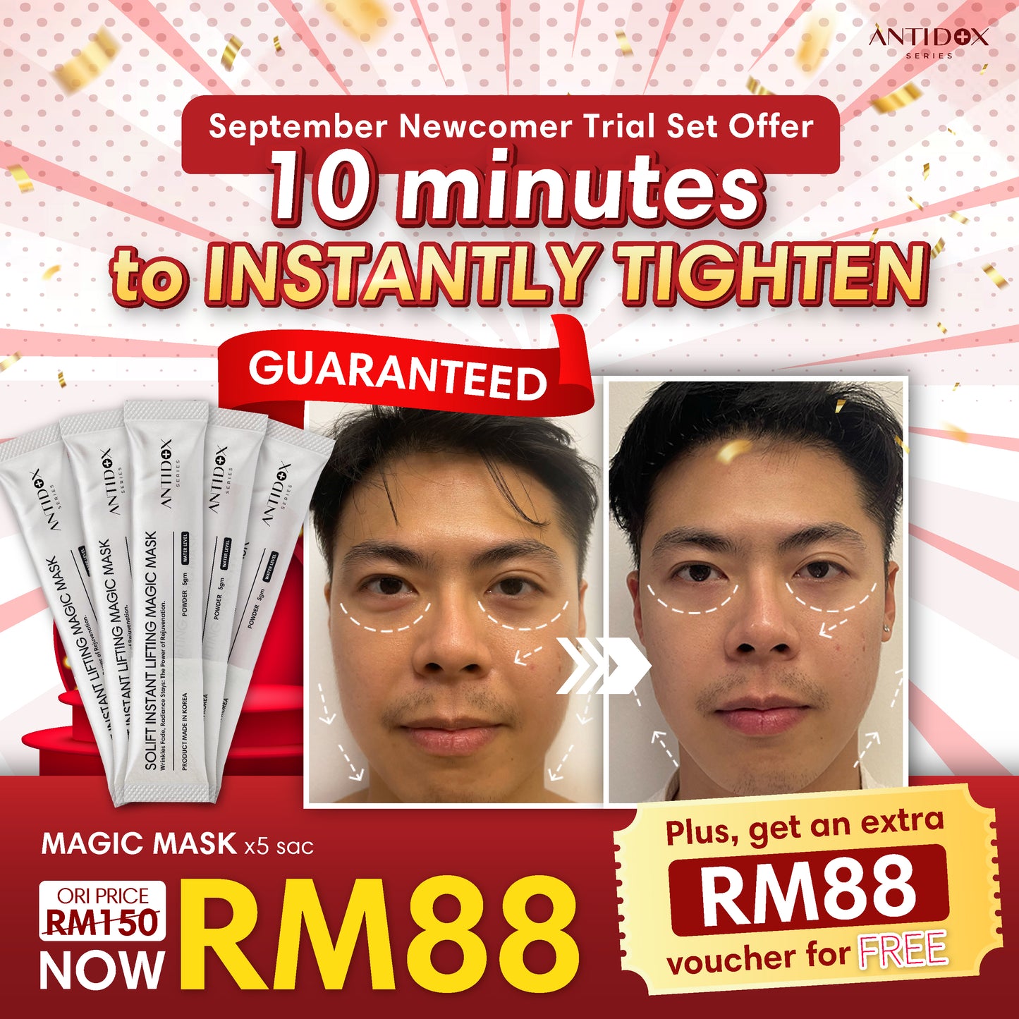 SEP SOLIFT TRIAL SET PROMOTION PACKAGE RM88