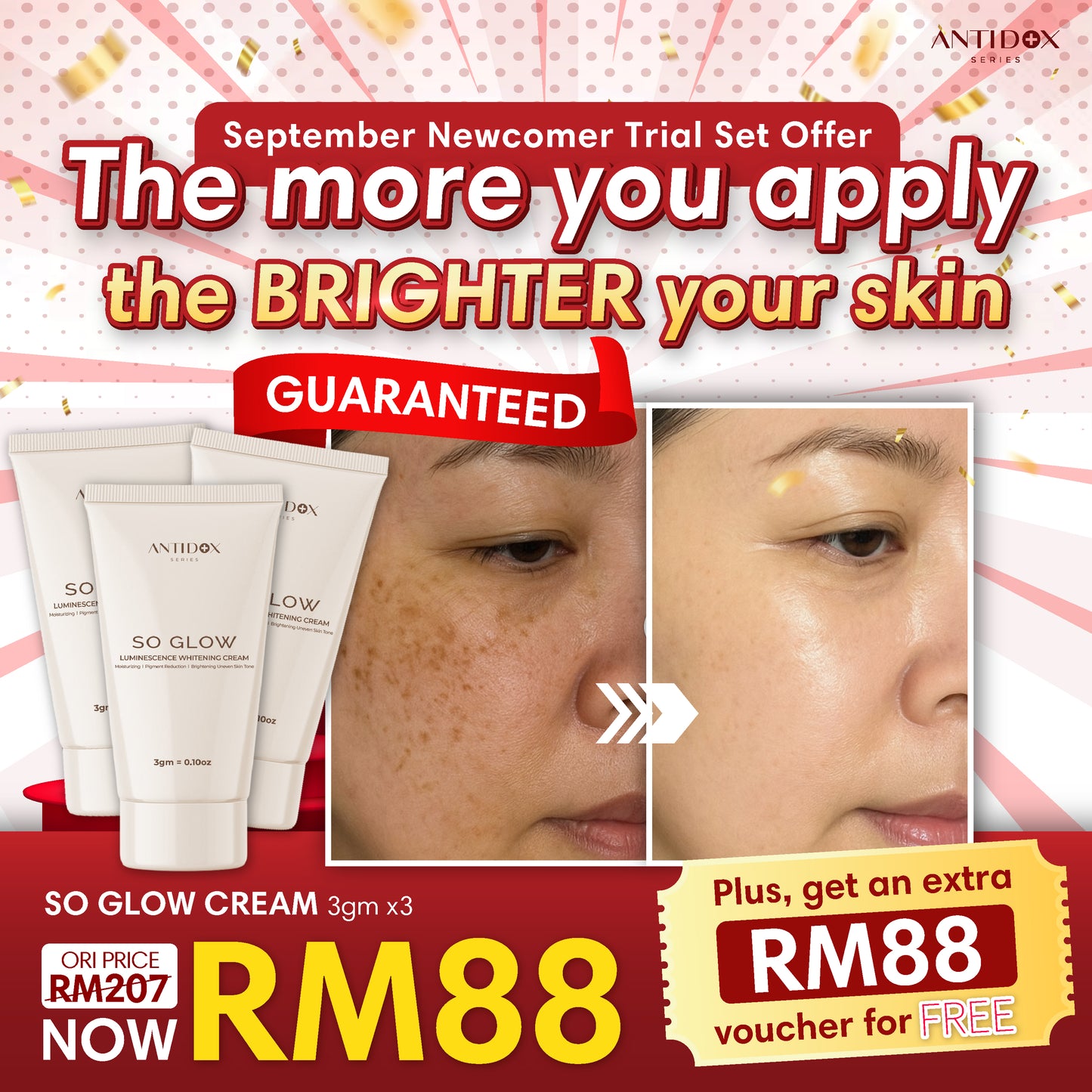 SEP SOLIFT TRIAL SET PROMOTION PACKAGE RM88