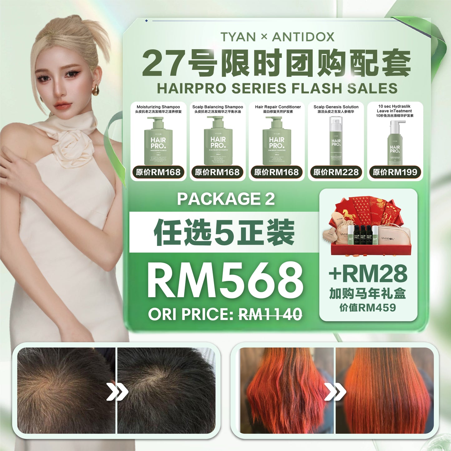 ANTIDOX HAIRPRO x TYAN PACKAGE RM568