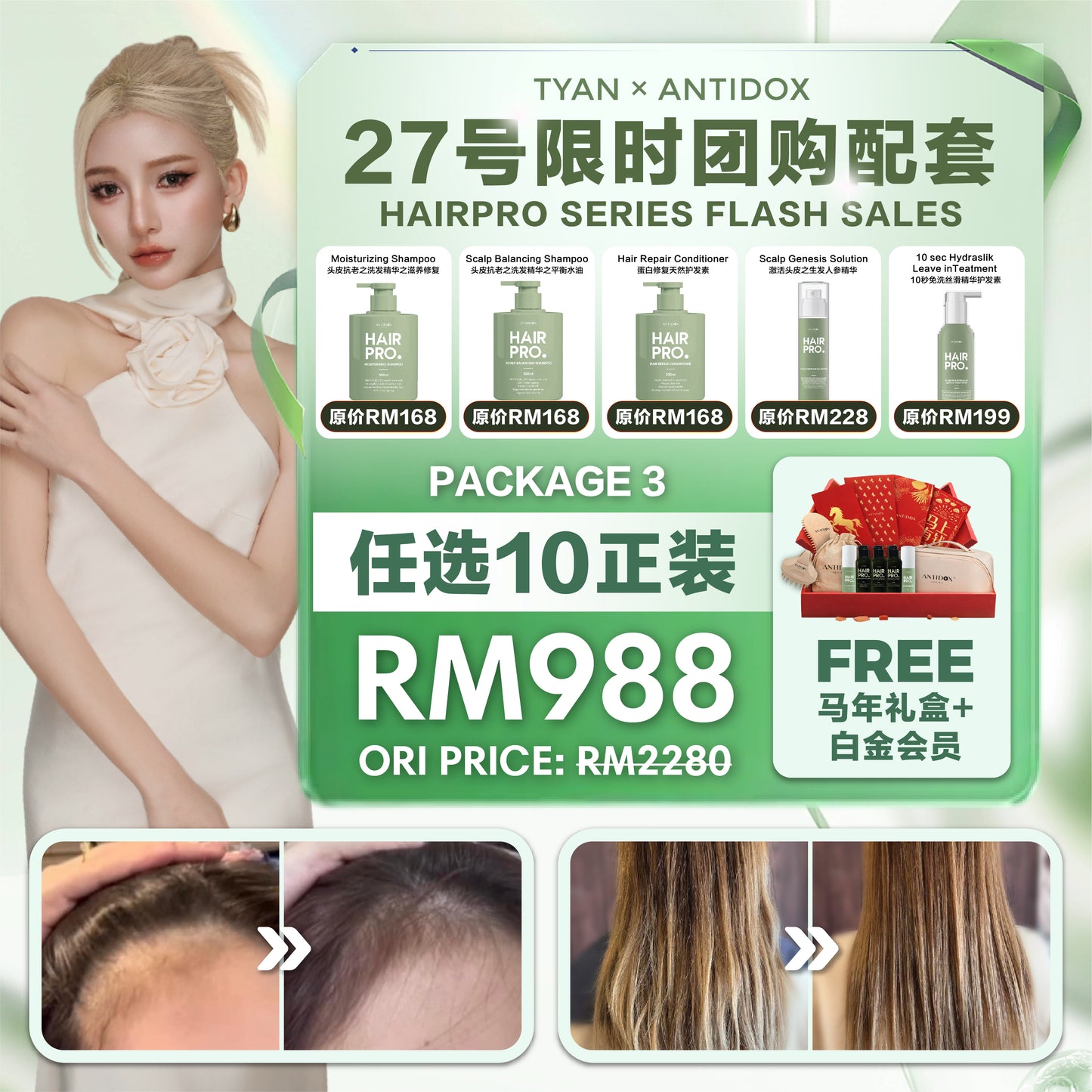 ANTIDOX HAIRPRO x TYAN PACKAGE RM988