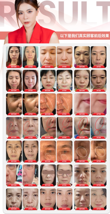 Antidox Series Official