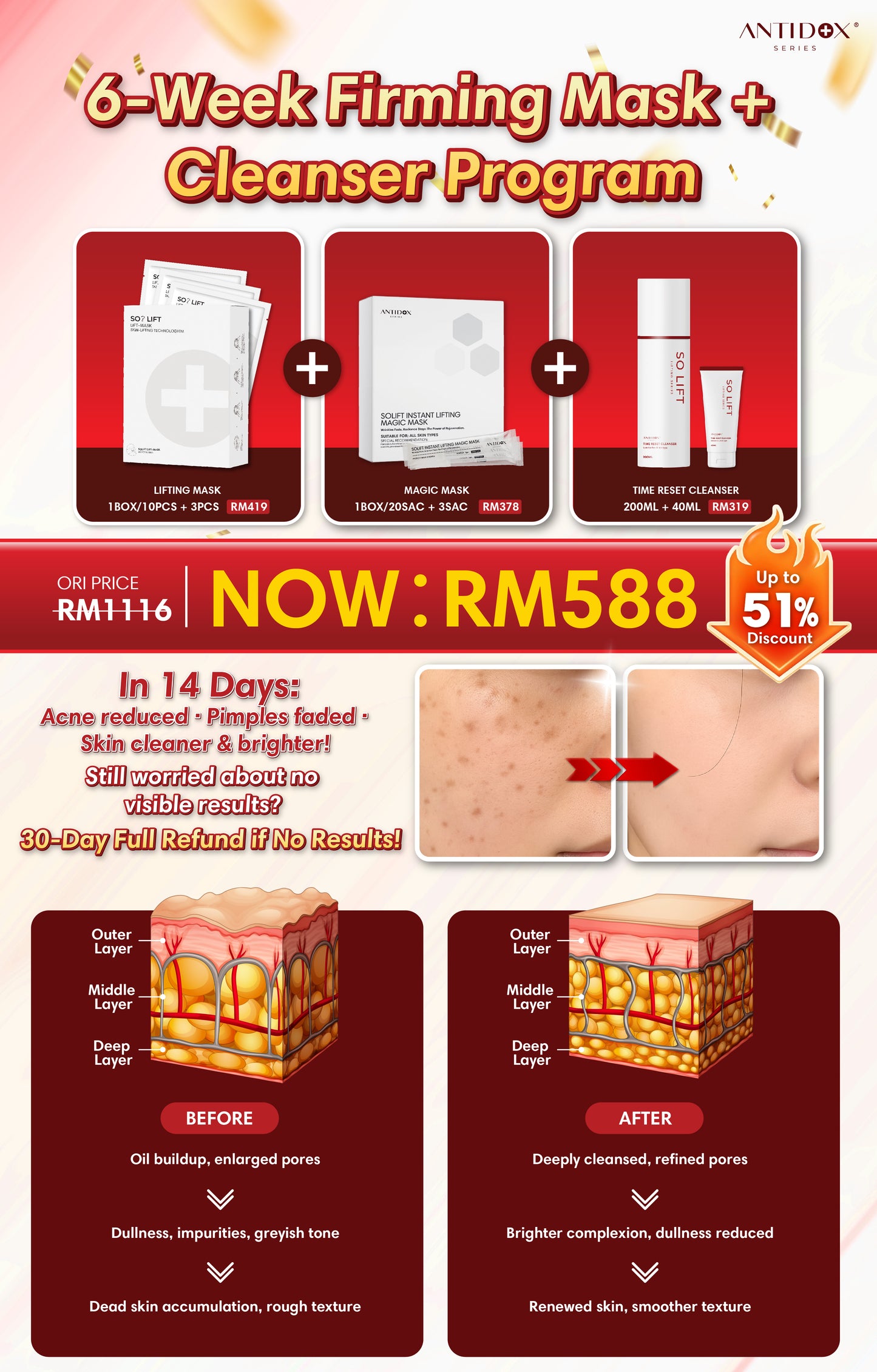 OCT SOLIFT 6-Week Treatment Package