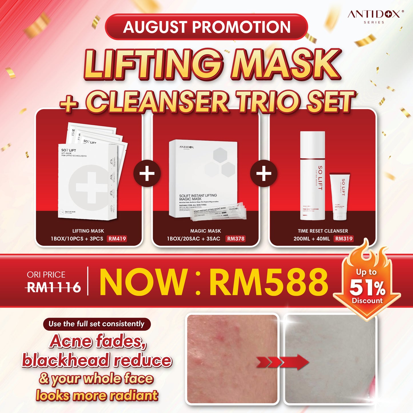 AUG SOLIFT PROMOTION PACKAGE RM588 LIFTING MASK + CLEANSER TRIO SET