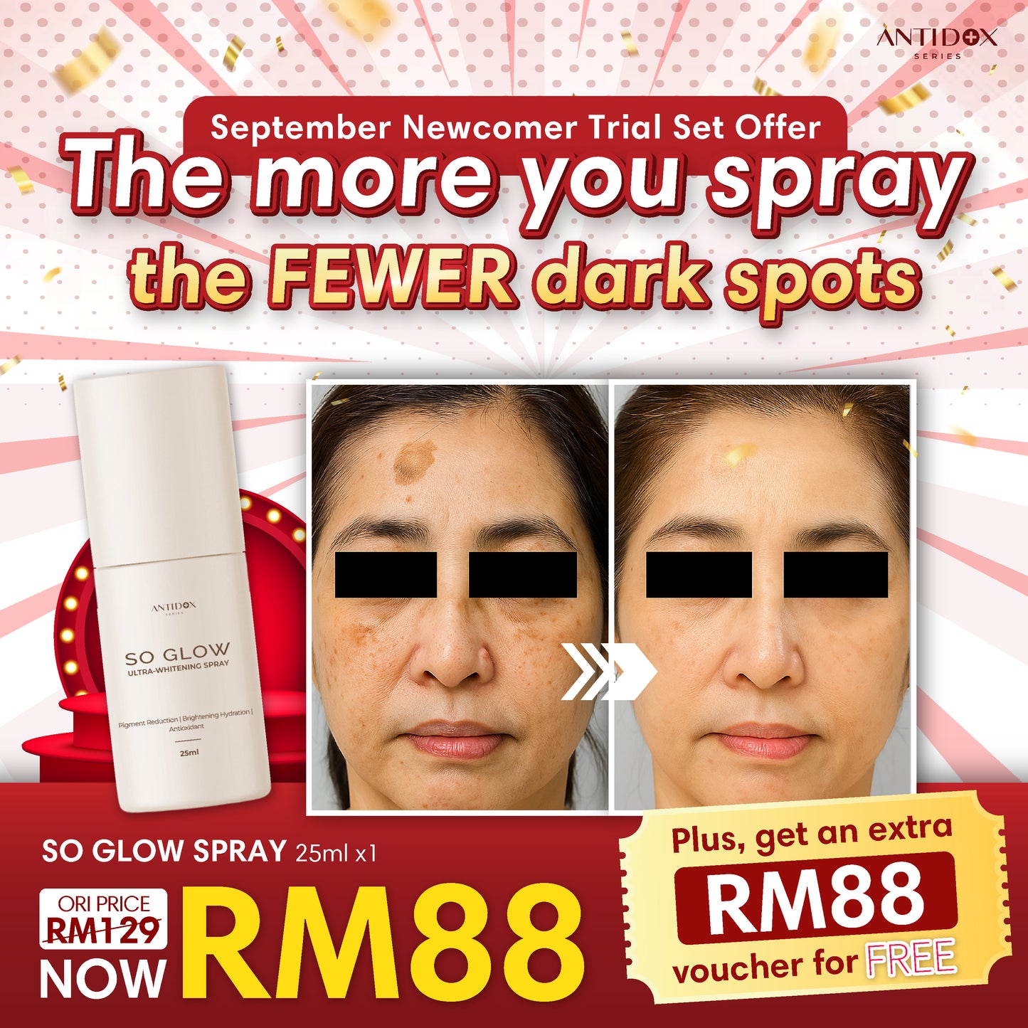 SEP SOLIFT TRIAL SET PROMOTION PACKAGE RM88
