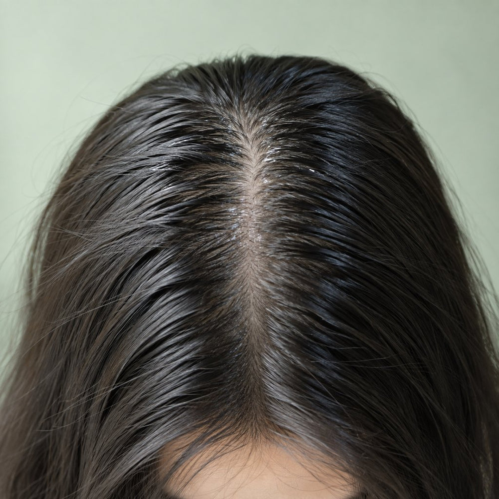 Oily scalp