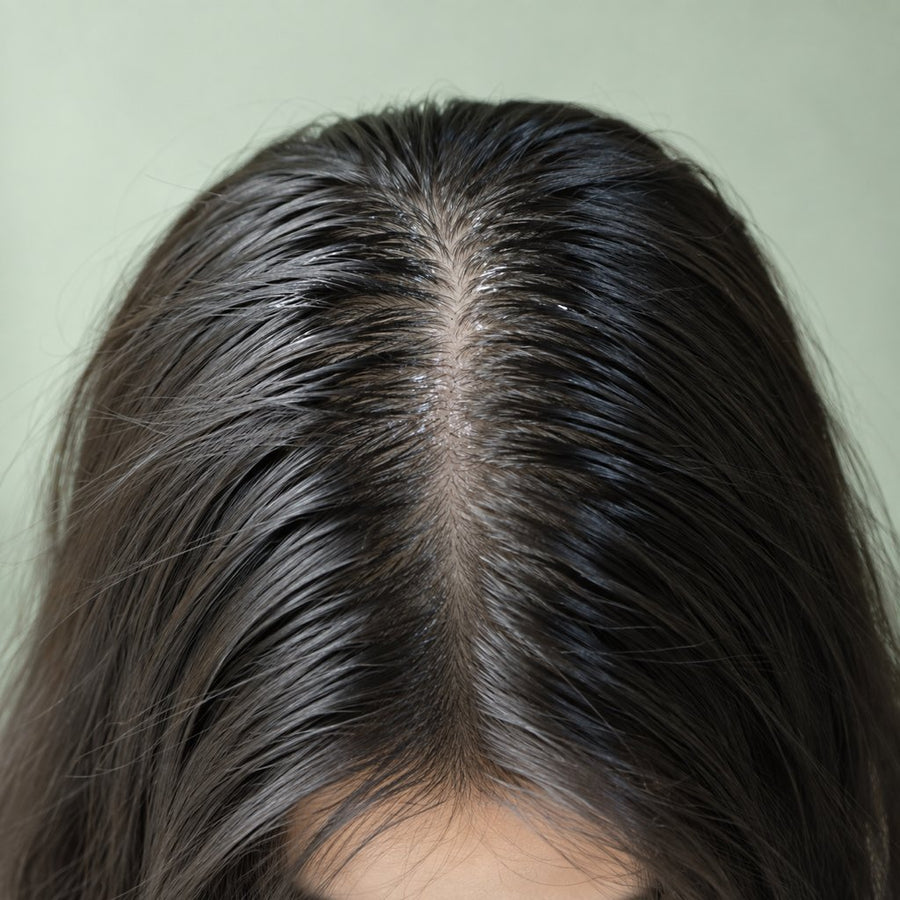 Oily scalp